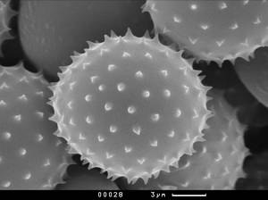 Urediniospores, Московская область (Россия)