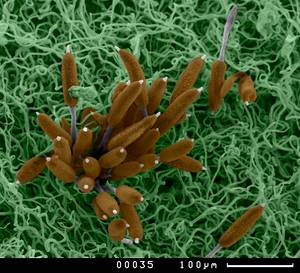 Teliospores on leaf surface, Московская область (Россия)
